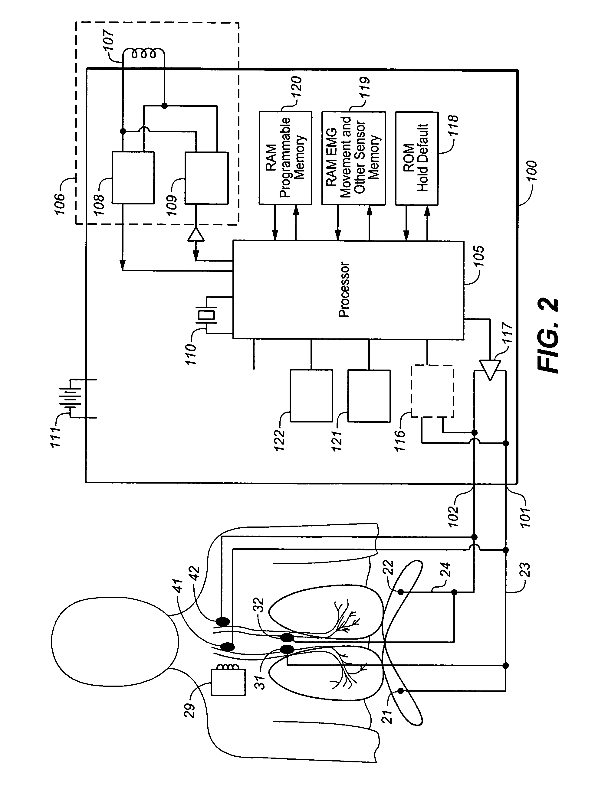 Device and method for increasing functional residual capacity