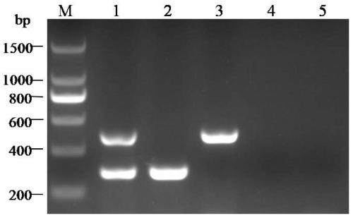 A dual-PCR detection method for sugarcane white leaf disease phytoplasma and Xanthomonas albus and its primer set