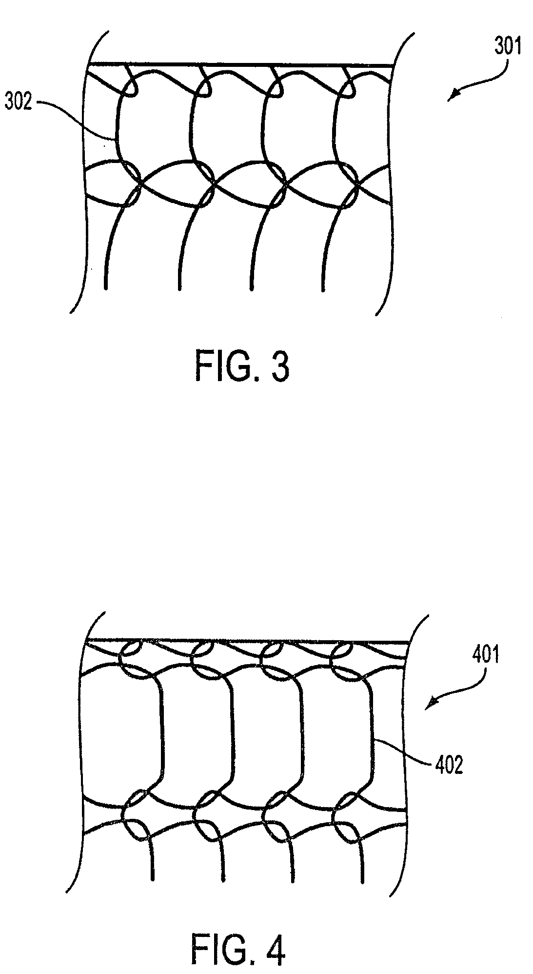 Composite stent with inner and outer stent elements and method of using the same
