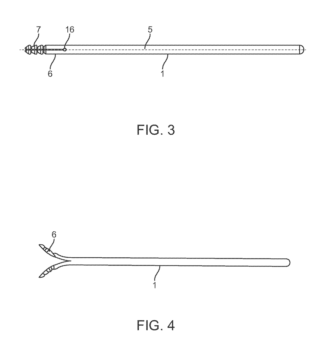 Implant and method for long bone fixation