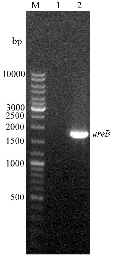 Immunologic adjuvant-Helicobacter pylori antigen fused protein oral vaccine and preparation method thereof