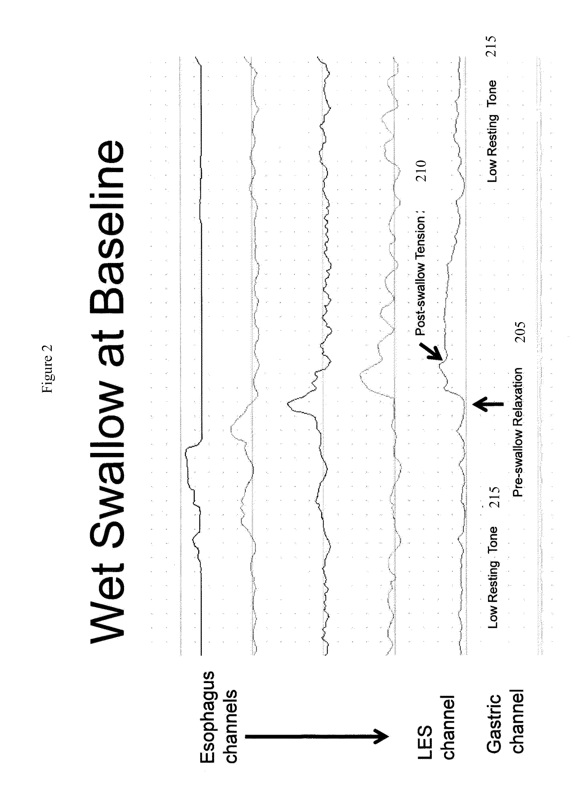 Device and implantation system for electrical stimulation of biological systems