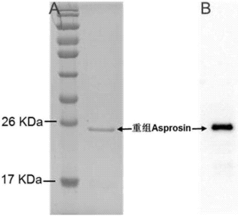 Application of Asprosin for preparing drugs for treating ischemic heart disease