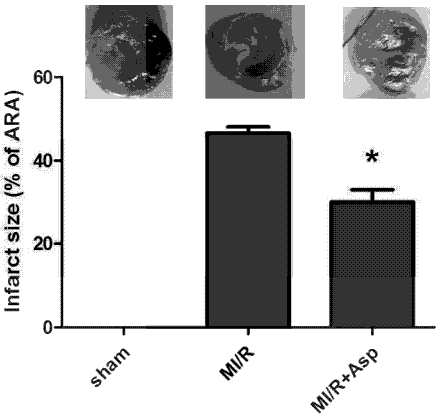 Application of Asprosin for preparing drugs for treating ischemic heart disease