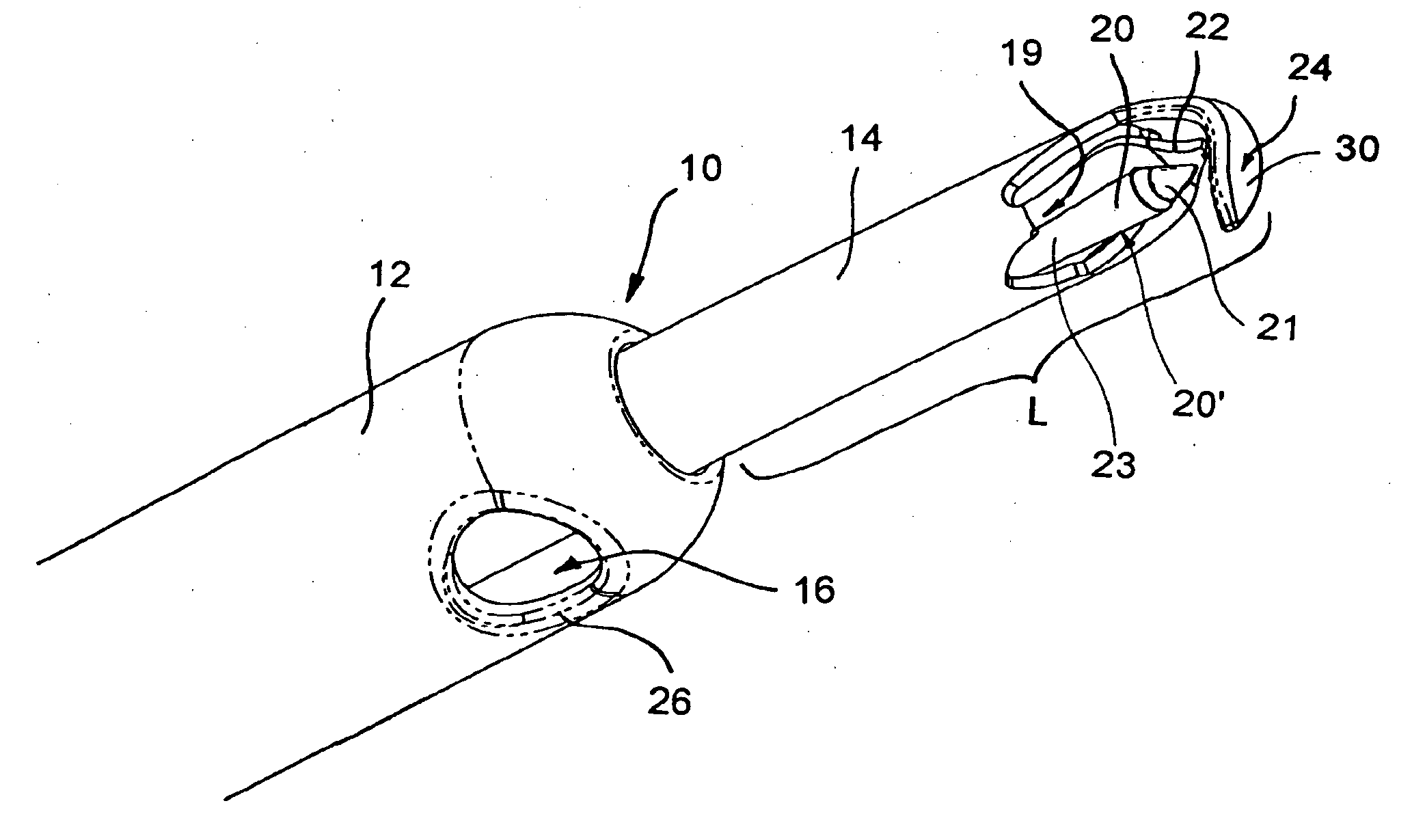 Devices and Methods Useable for Treatment of Glaucoma and Other Surgical Prcedures