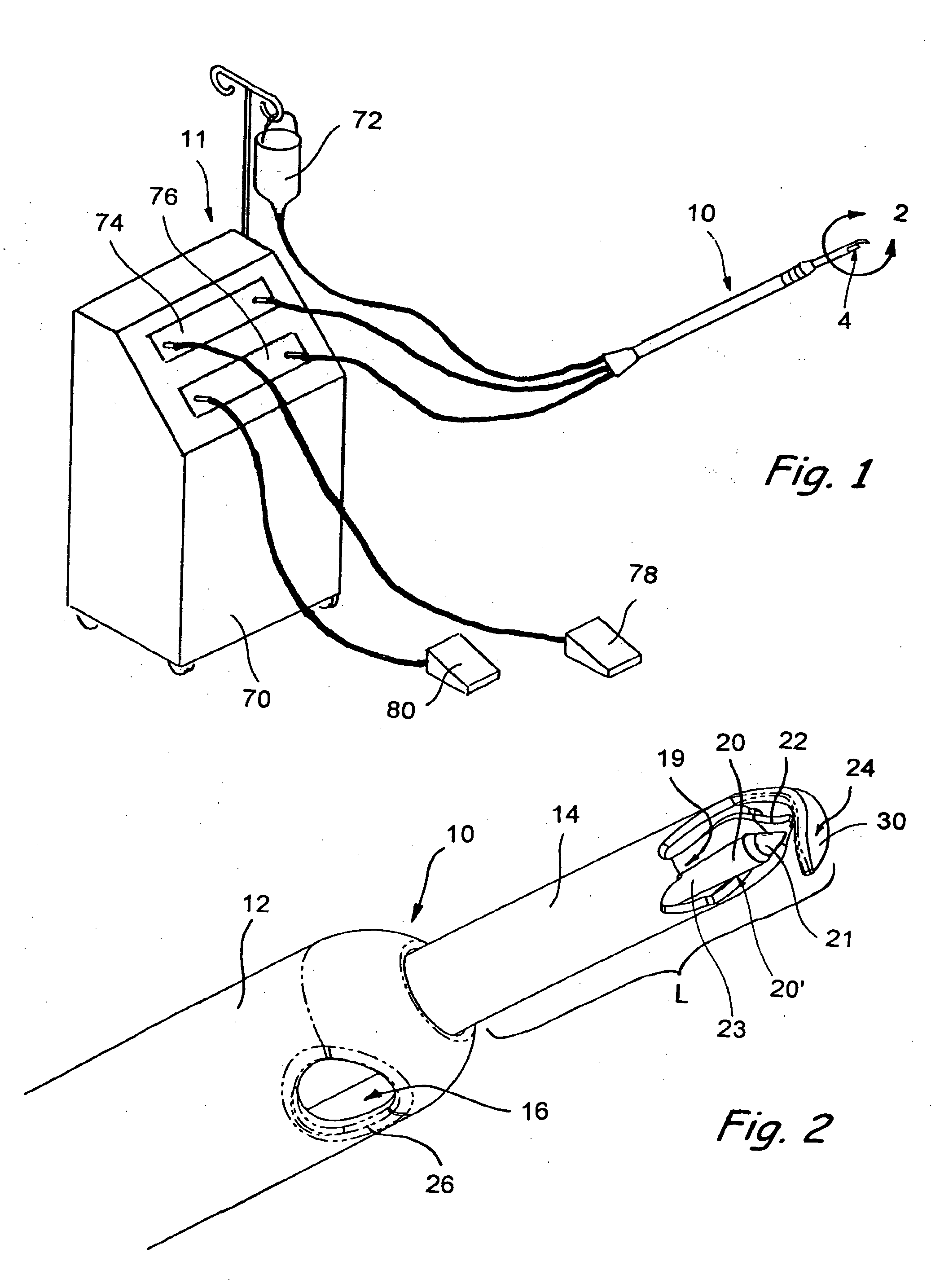 Devices and Methods Useable for Treatment of Glaucoma and Other Surgical Prcedures
