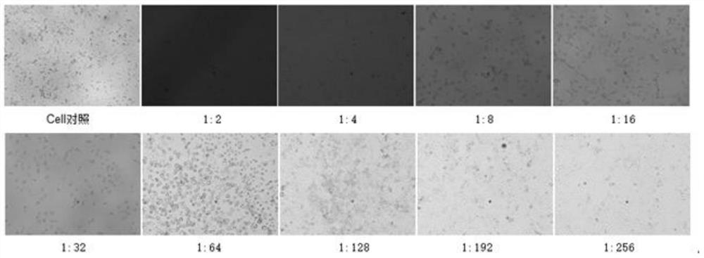 Application of Xiasangju in the preparation of medicines for preventing and treating hand-foot-mouth disease