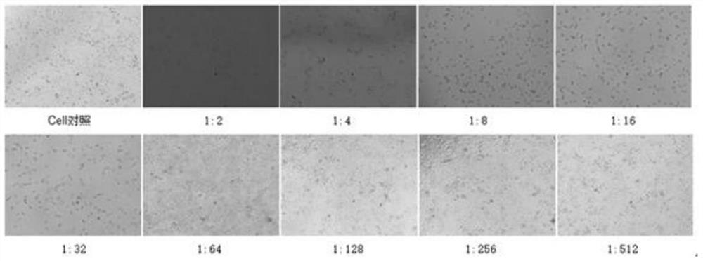 Application of Xiasangju in the preparation of medicines for preventing and treating hand-foot-mouth disease