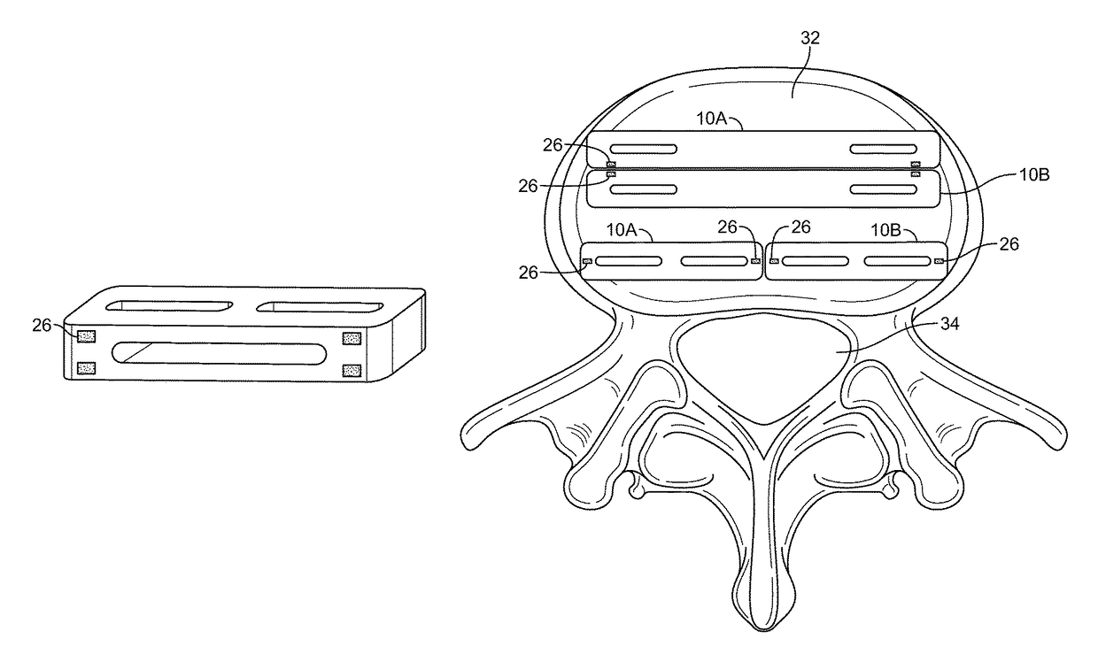 Magnetically connectable interbody spinal implant devices