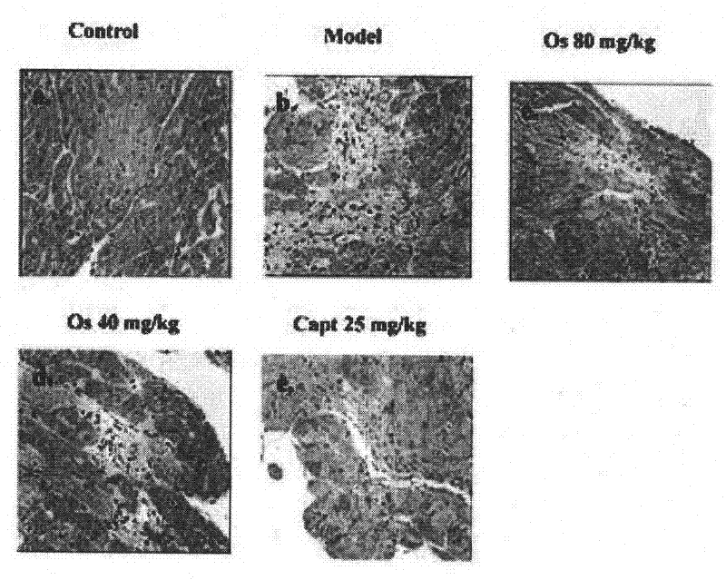 Application of osthole in preparation of medicament for preventing and treating myocardial fibrosis