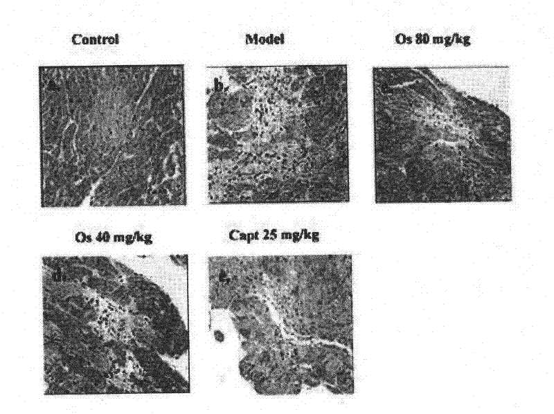 Application of osthole in preparation of medicament for preventing and treating myocardial fibrosis