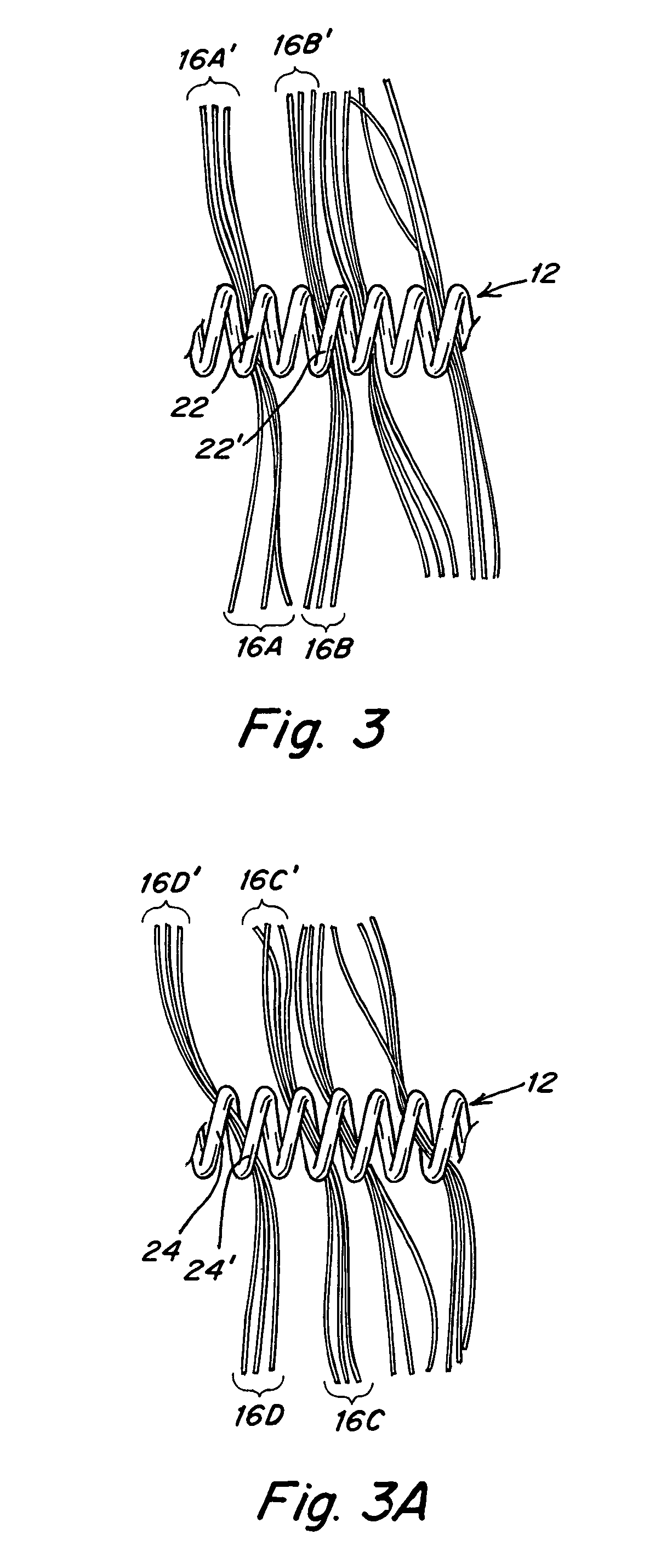 Metallic coils enlaced with biological or biodegradable or synthetic polymers or fibers for embolization of a body cavity