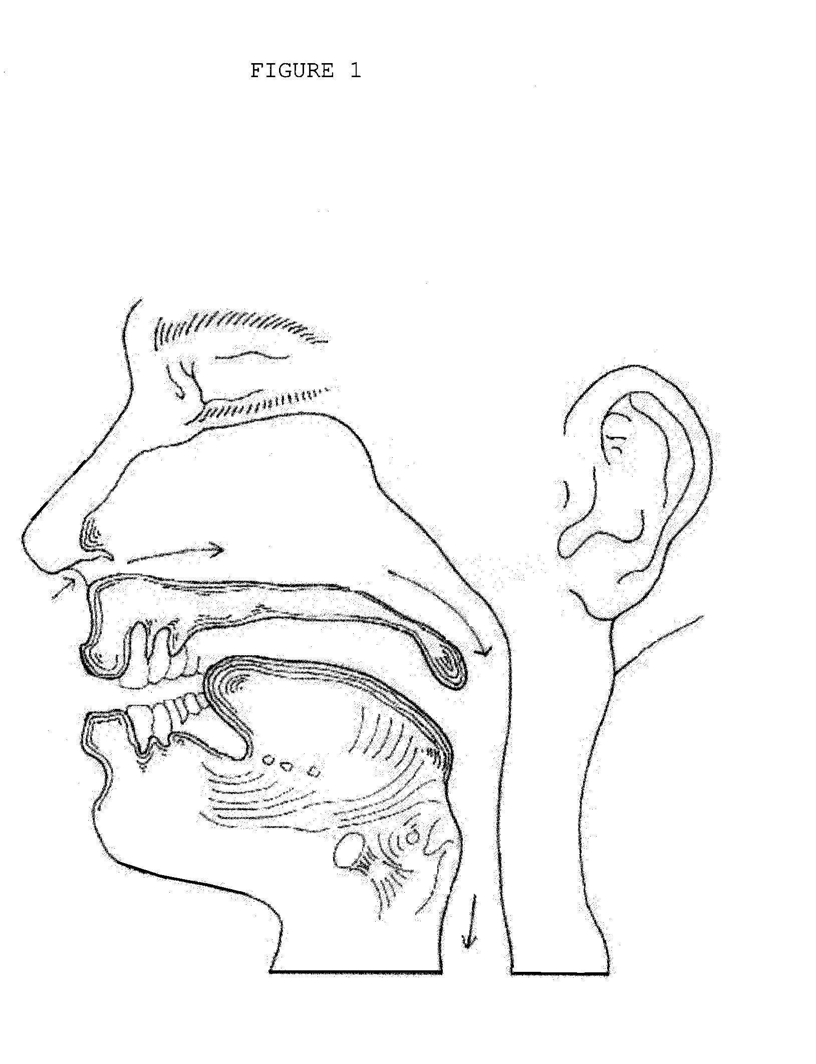 Integrated oral appliance for sleep-disordered breathing