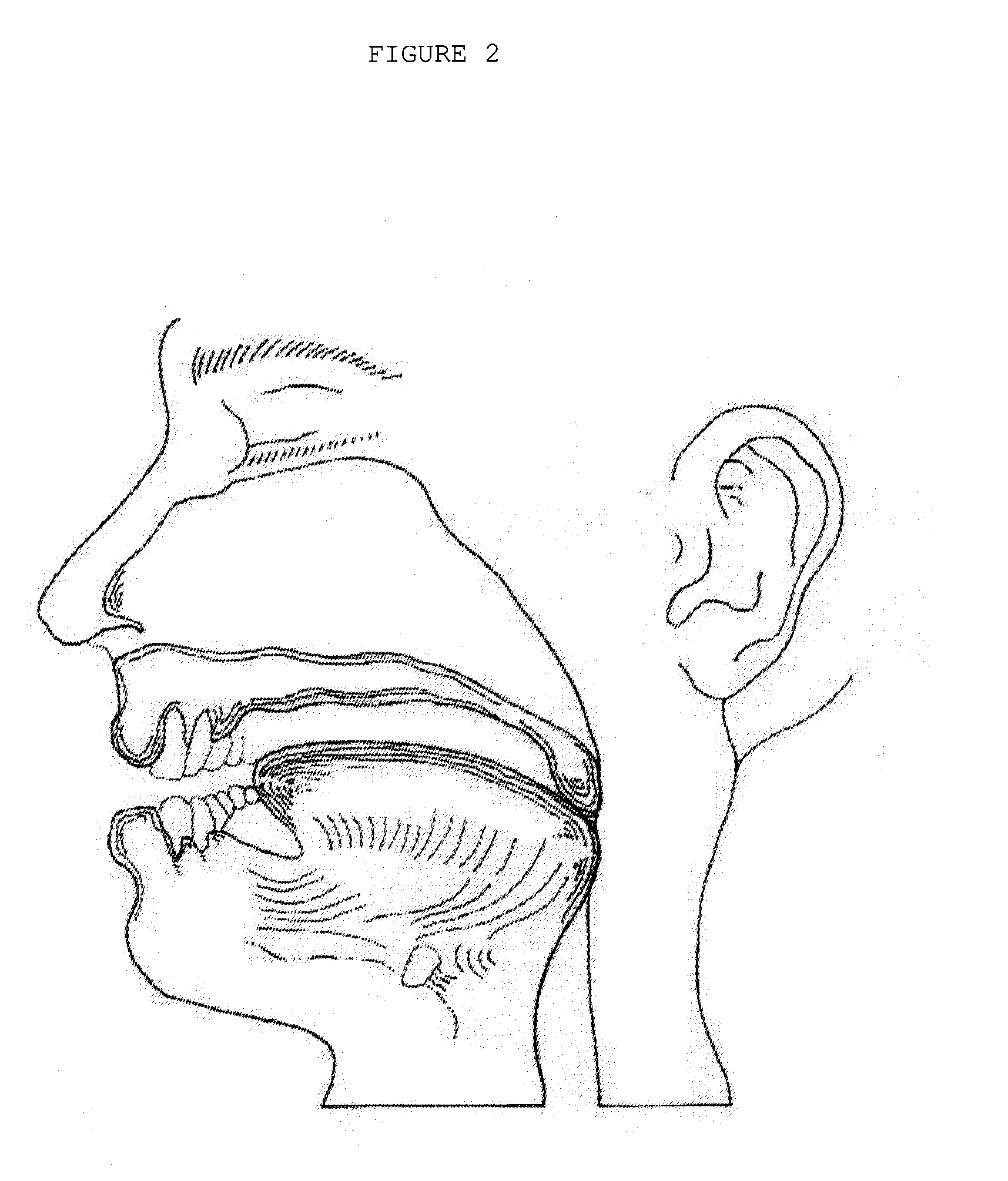 Integrated oral appliance for sleep-disordered breathing