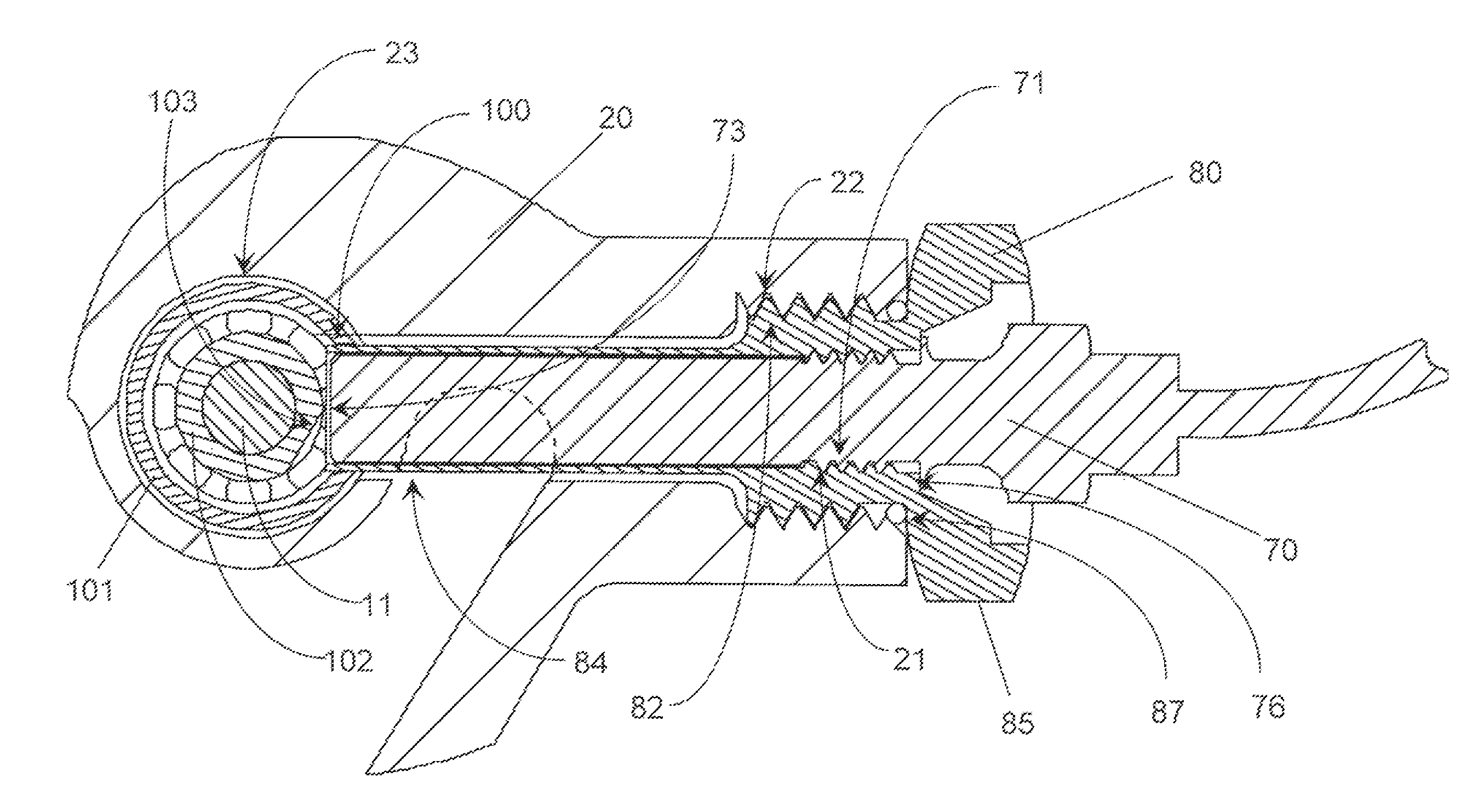 Speed sensor insert with bearing spacer indexing for a turbocharger