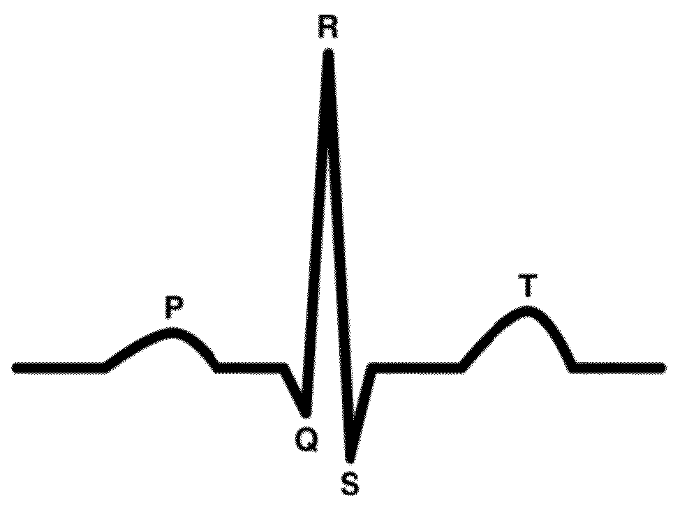 Electrocardiogram signal compression and de-compression system
