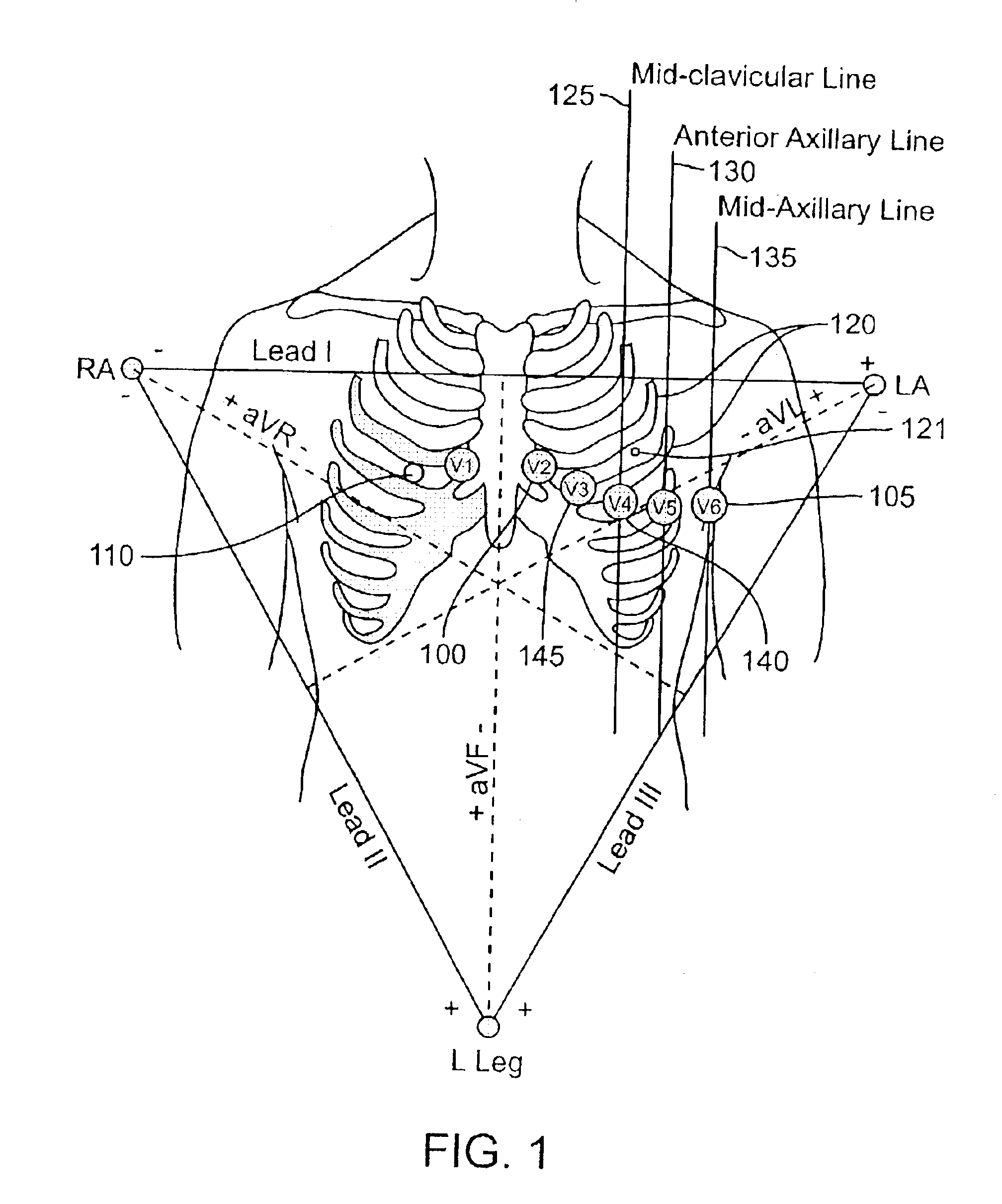 Method and apparatus for determining metabolic factors from an electrocardiogram