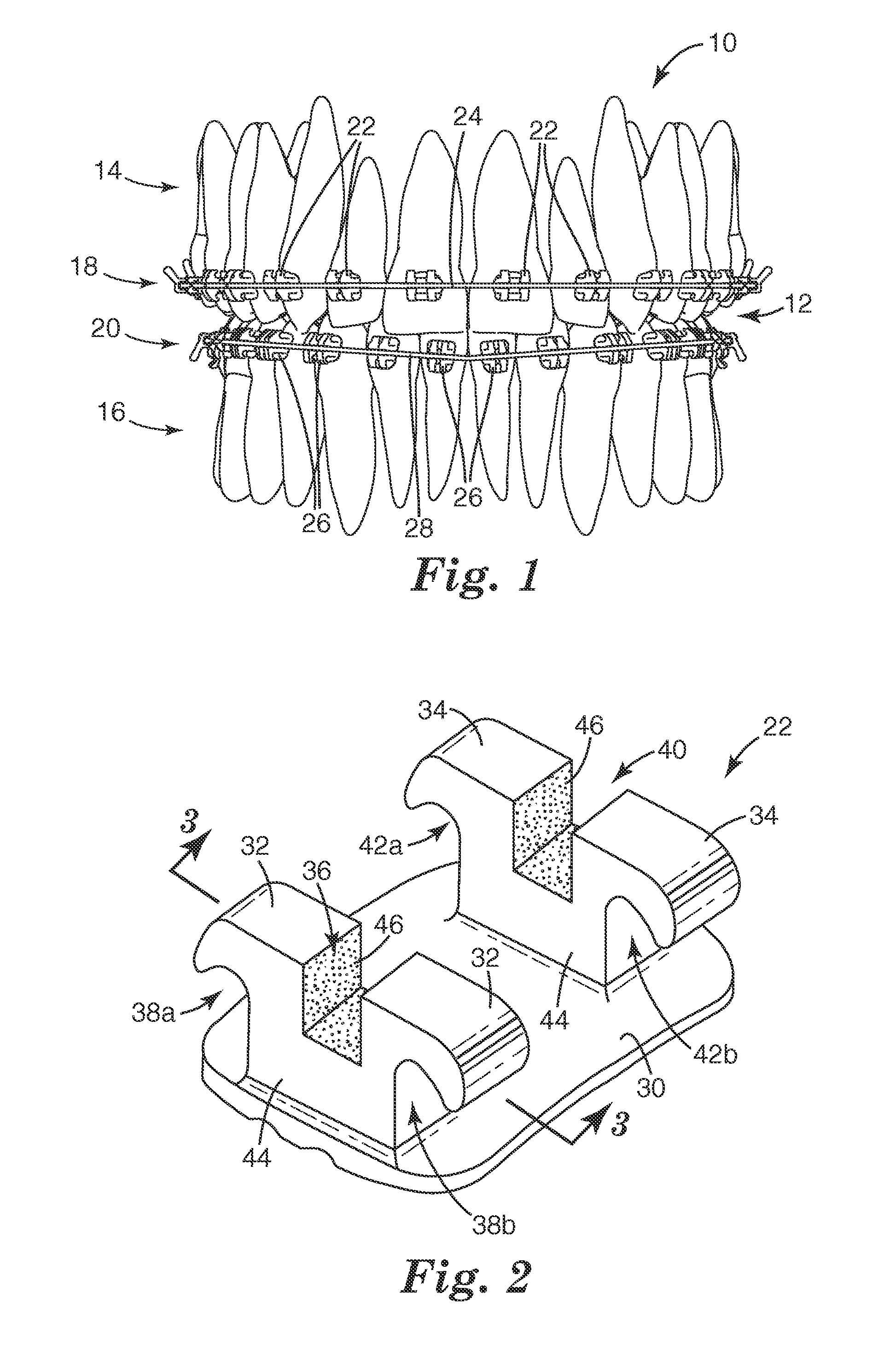 Coated Dental Articles and Related Methods of Manufacture