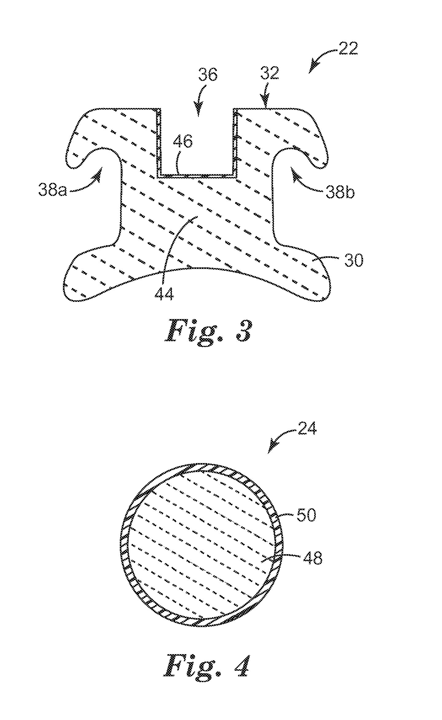 Coated Dental Articles and Related Methods of Manufacture