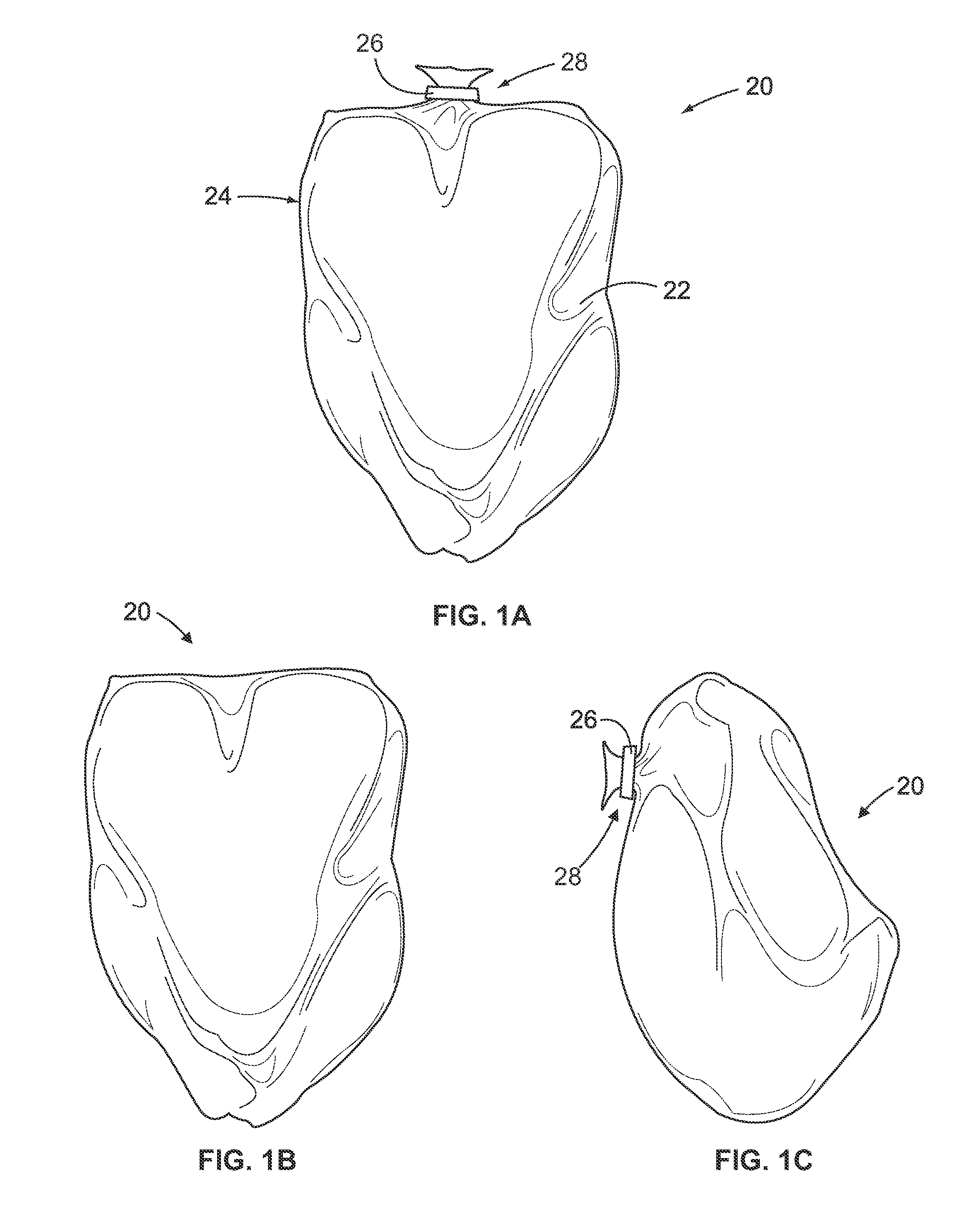 Method and system for bagging material