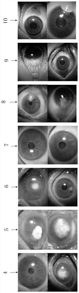Common ocular surface disease diagnosis system based on intelligent terminal