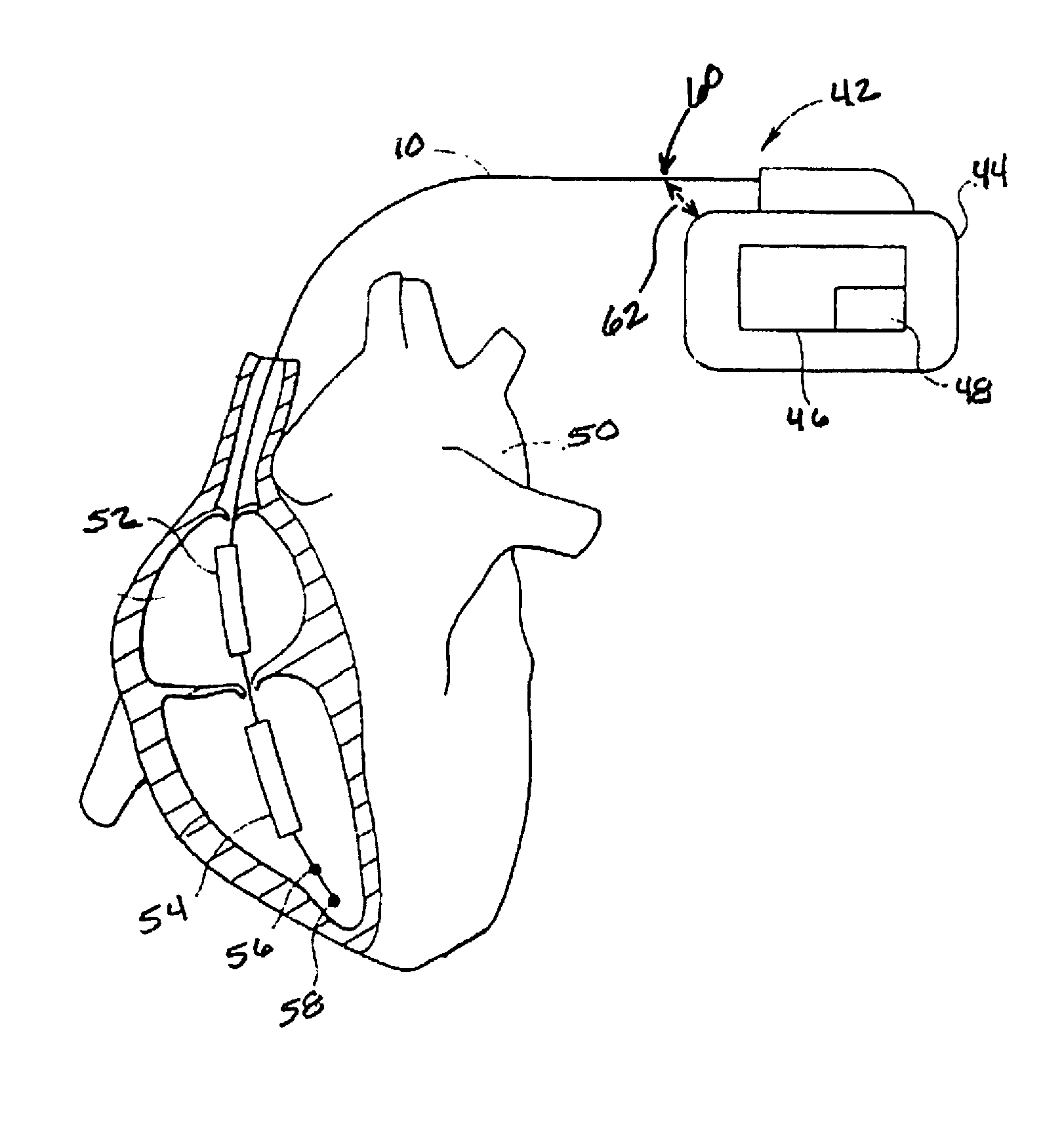 Method for detecting and treating insulation lead-to-housing failures