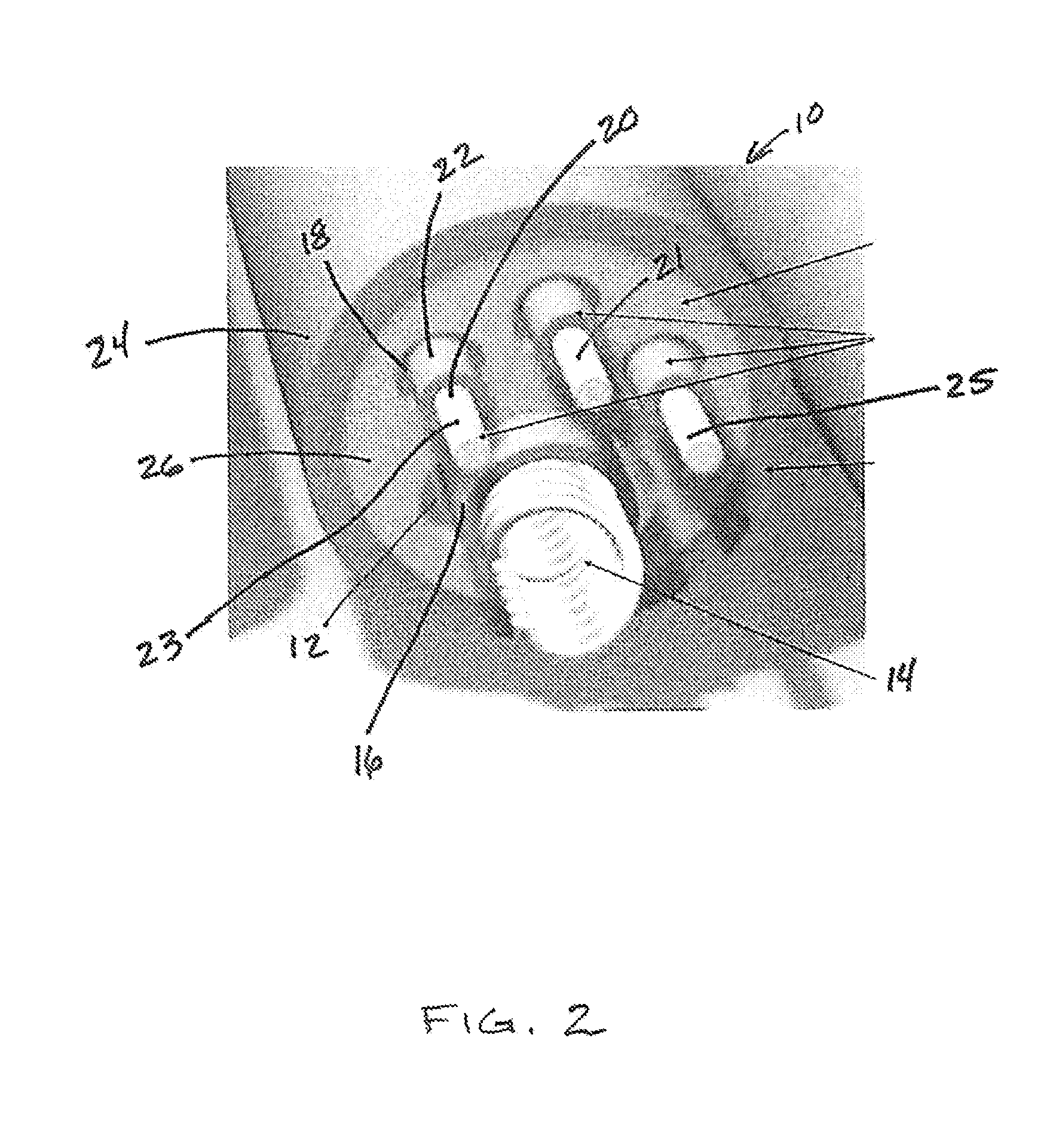 Method for detecting and treating insulation lead-to-housing failures