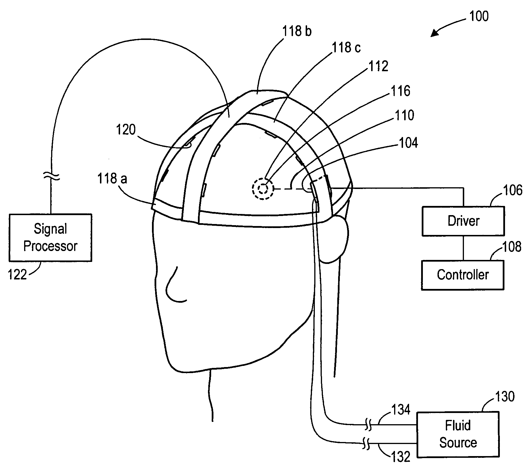 Apparatus and methods for delivering acoustic energy to body tissue
