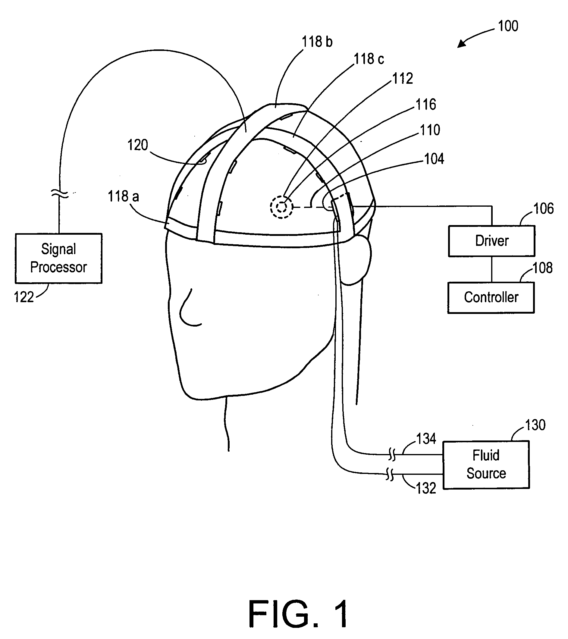 Apparatus and methods for delivering acoustic energy to body tissue