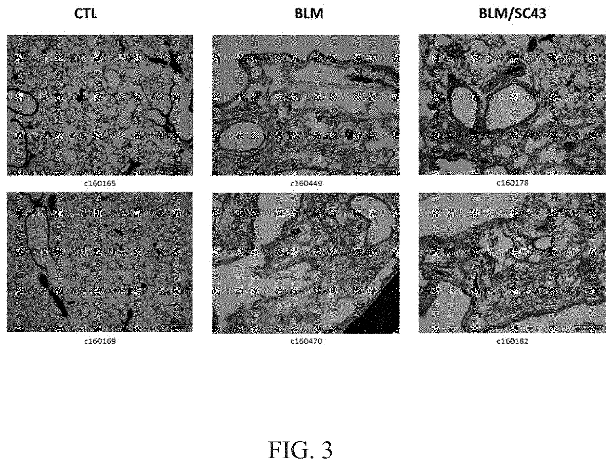 Method for ameliorating fibrosis using 1-[4-chloro-3-(trifluoromethyl)phenyl]-3-[3-(4-cyanophenoxy)phenyl]urea