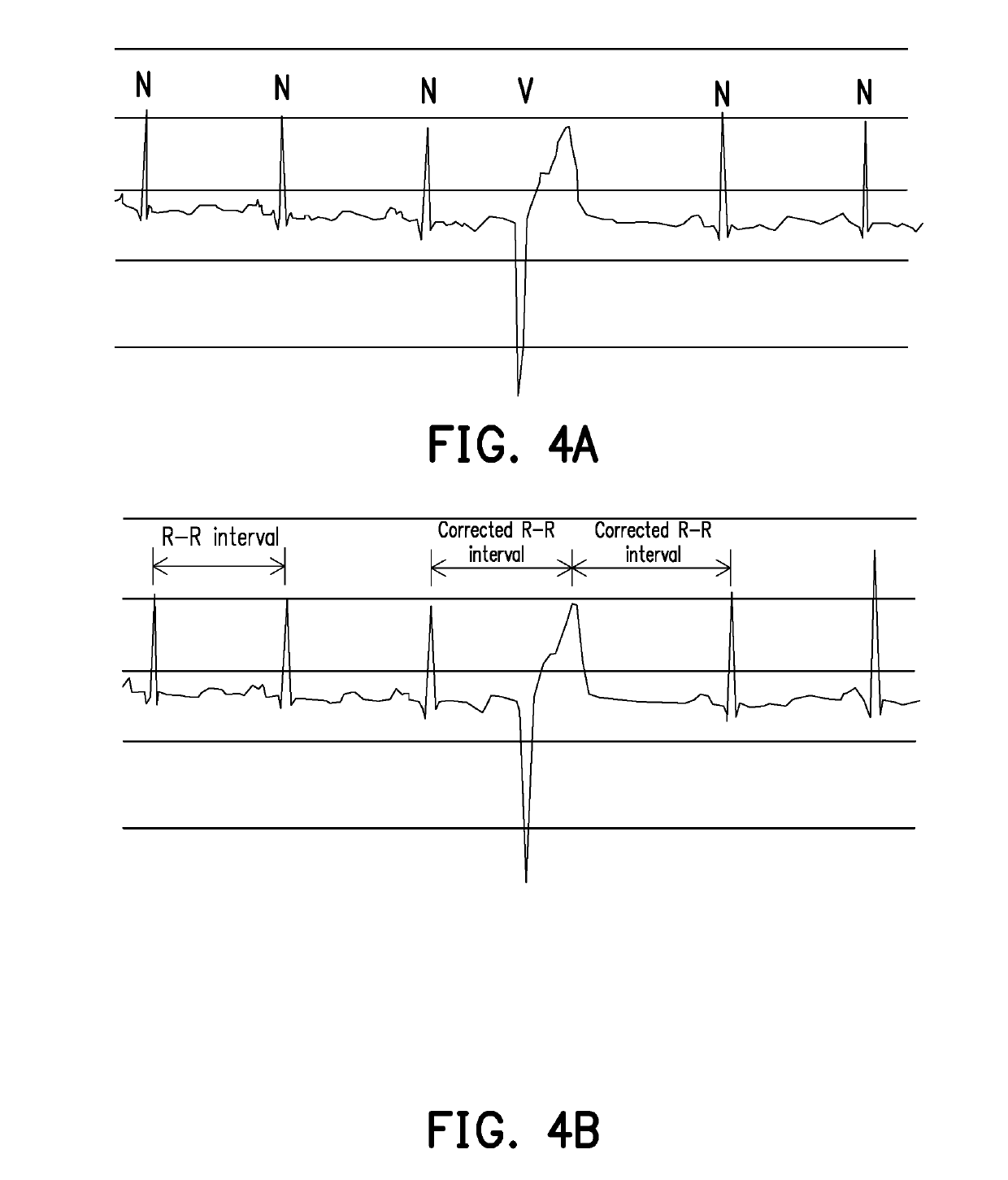 Computation apparatus, cardiac arrhythmia assessment method thereof and non-transitory computer-readable recording medium