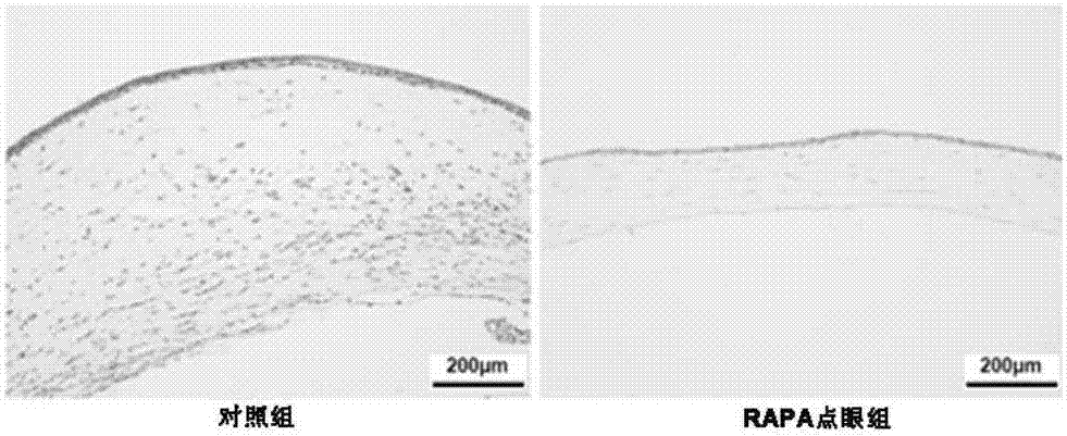 Rapamycin nano-micelle eye drops and preparation method thereof