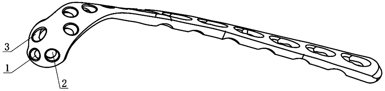 Humeral distal-end posterior-lateral locking plate