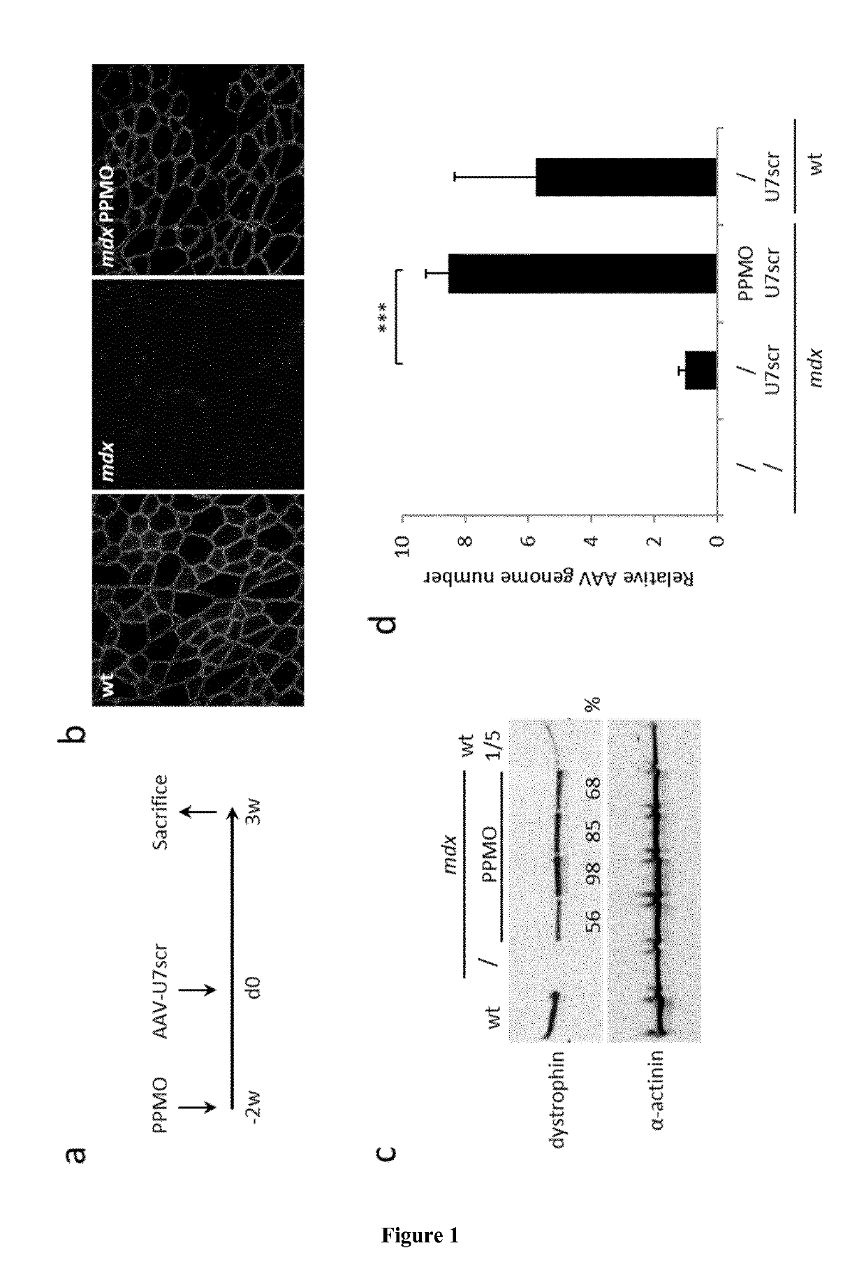 Combined therapy for duchenne muscular dystrophy