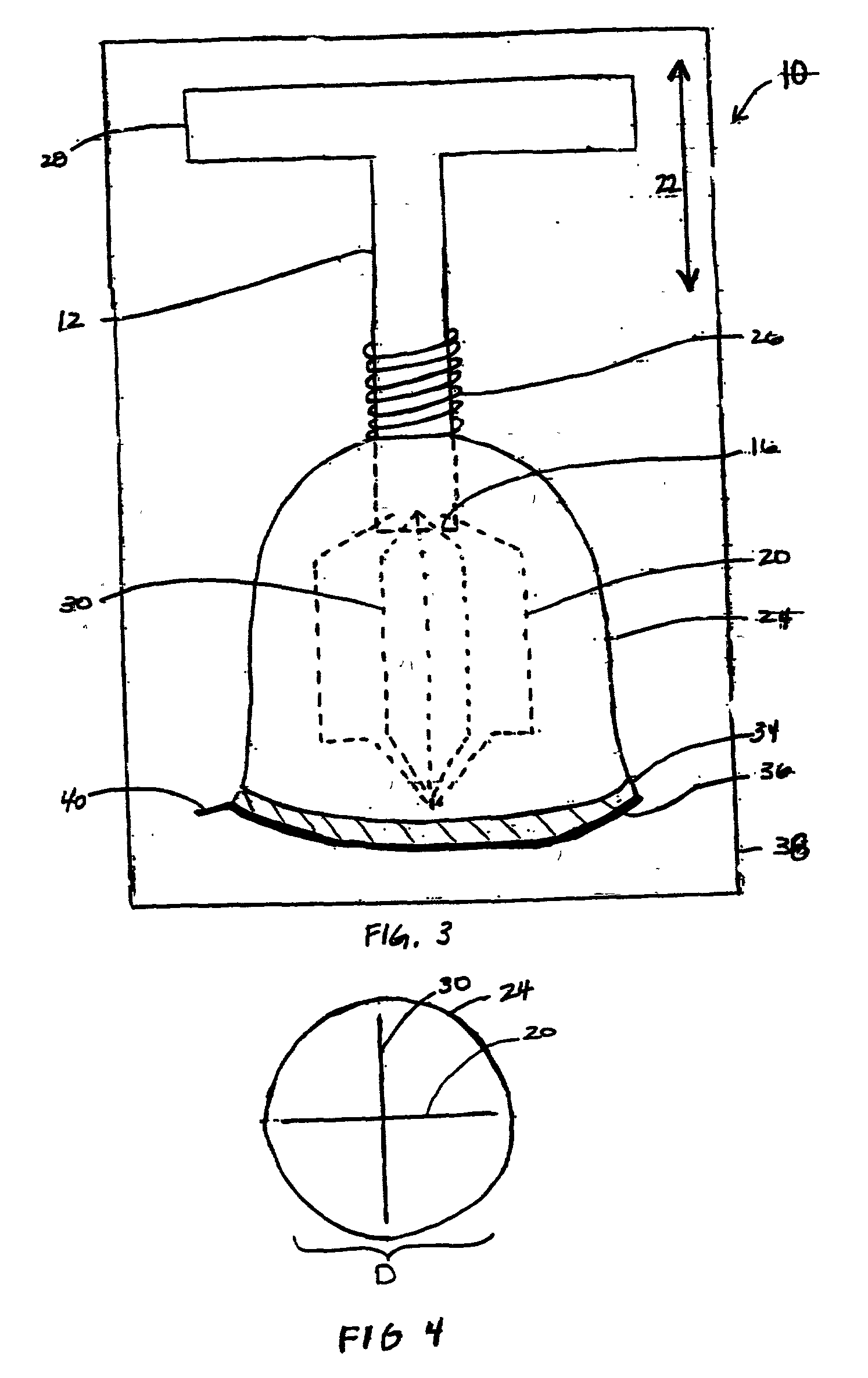 Methods and apparatus for intercostal access