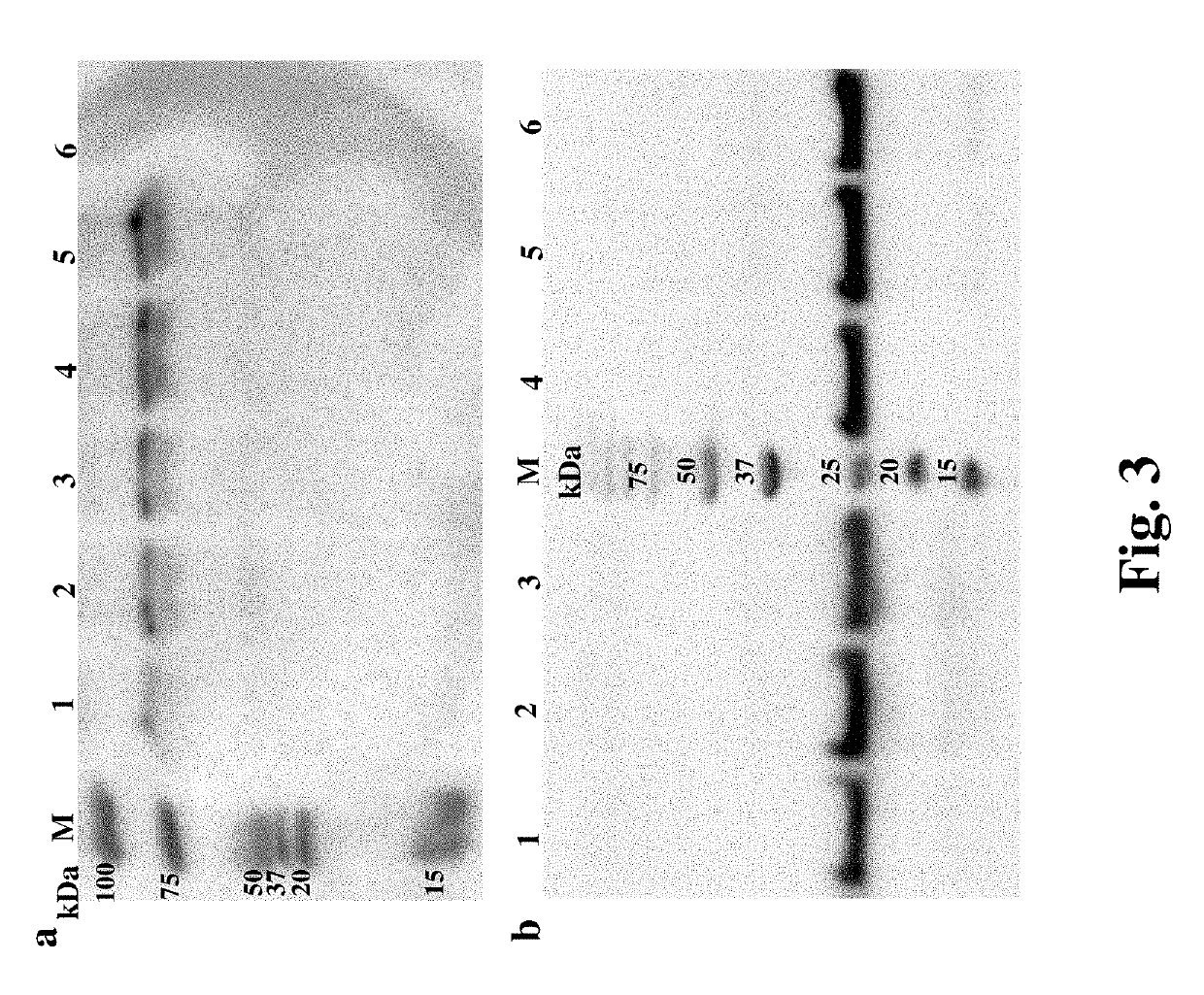 Methods for improving expression levels of foreign proteins by means of phospholipase fusion expression