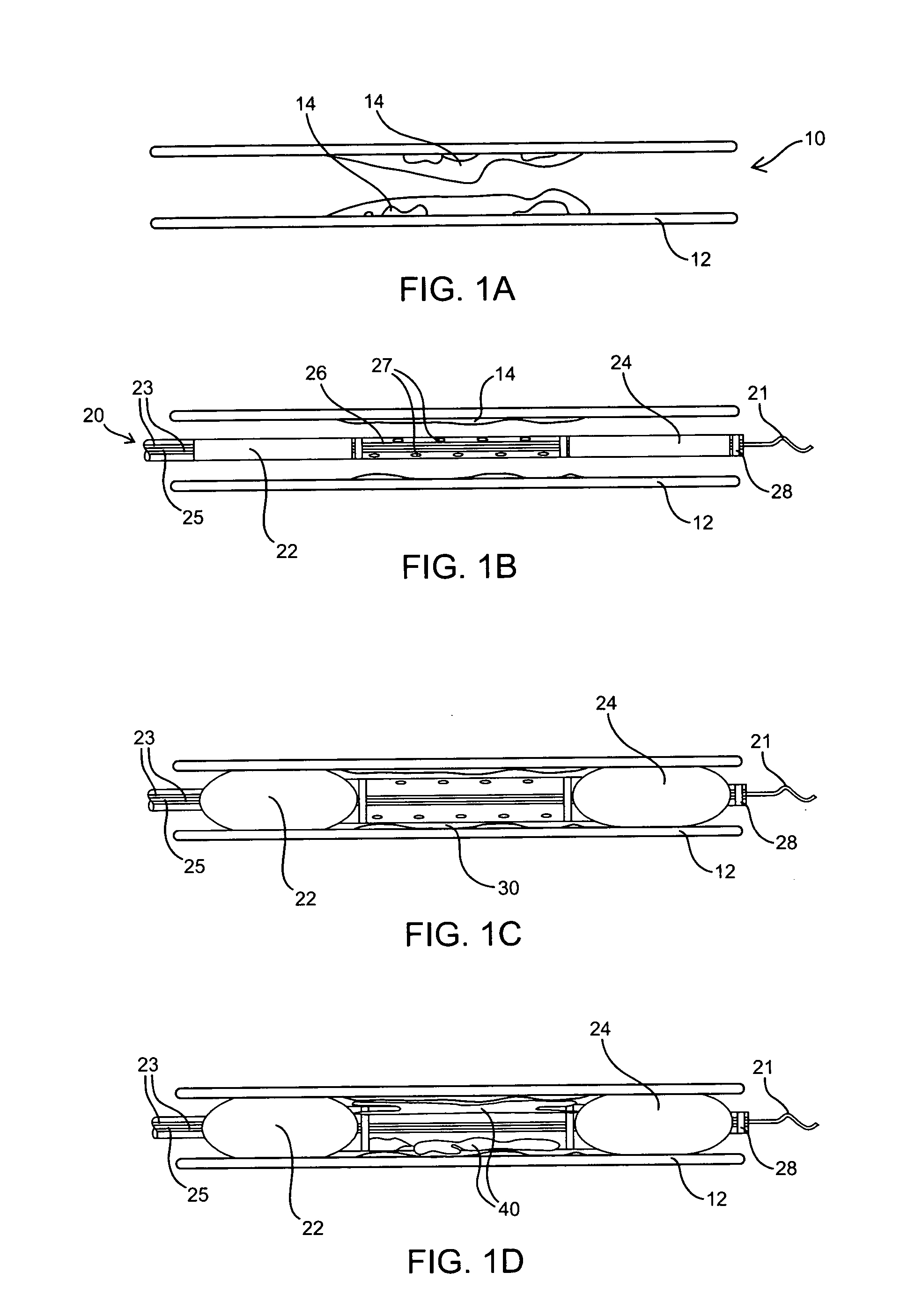 Biocompatible phase invertable proteinaceous compositions and methods for making and using the same