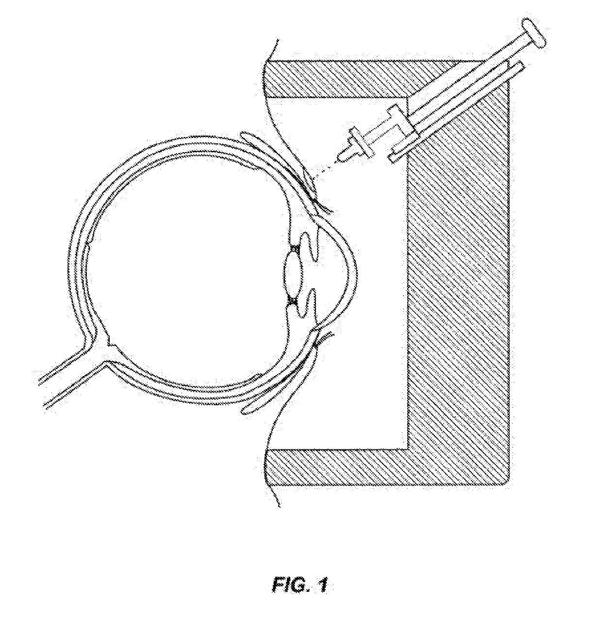 Non-invasive tonometer for intraocular pressure measurement and tissue durometer