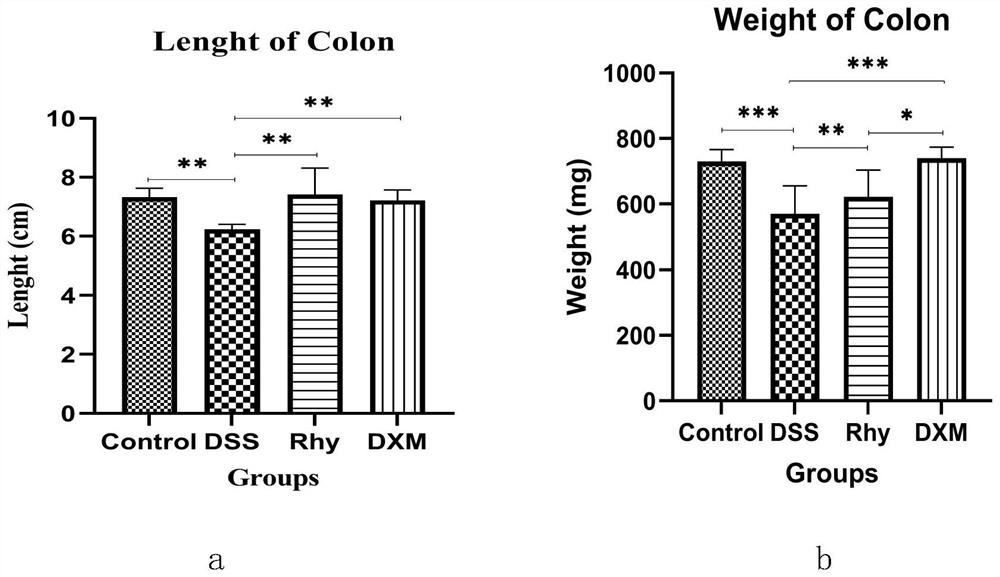 Application of rhynchophylline in preparation of medicine for treating inflammatory enteritis