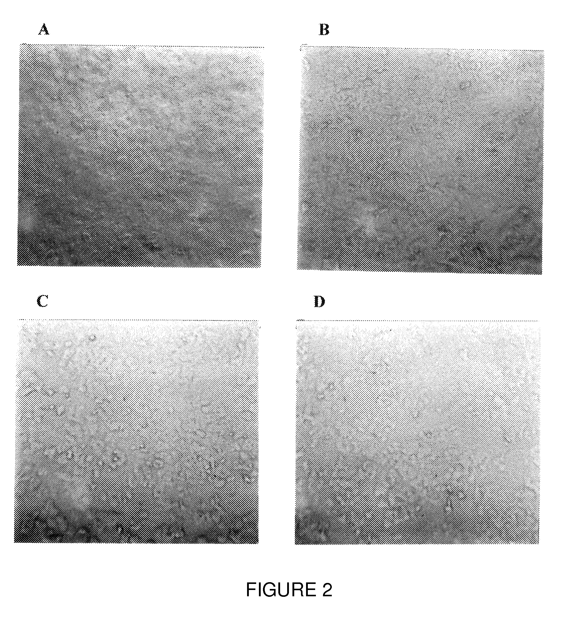Compositions and methods to enhance viability and function of islet cells