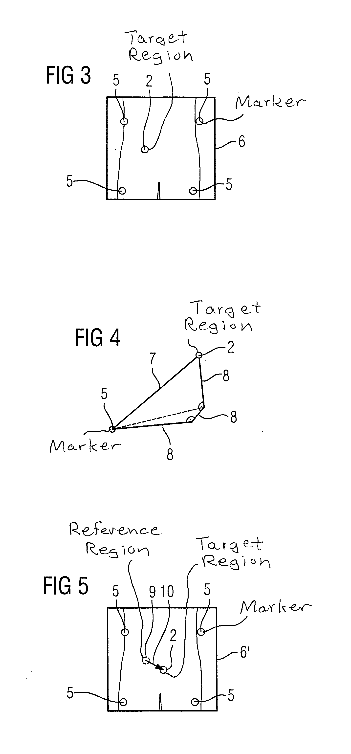 Method and position determination system for determining a position of a target region of a patient to be irradiated in an irradiation device