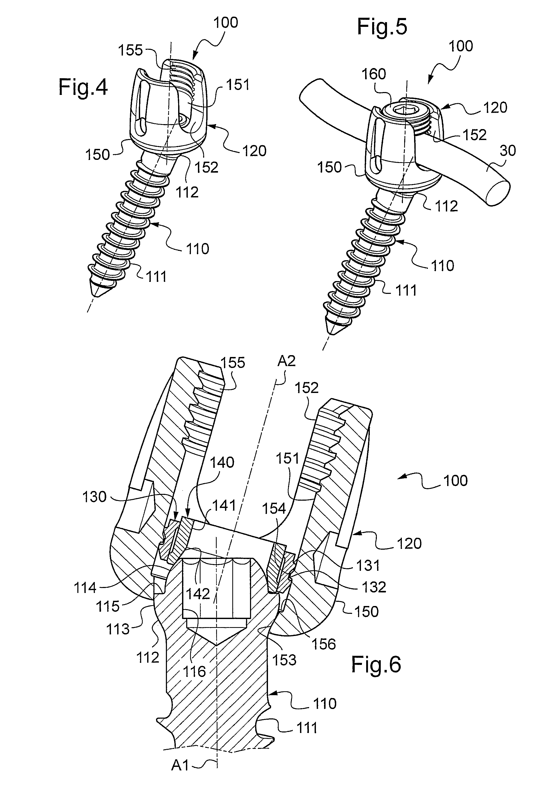 Spinal implant with a lockable ball joint