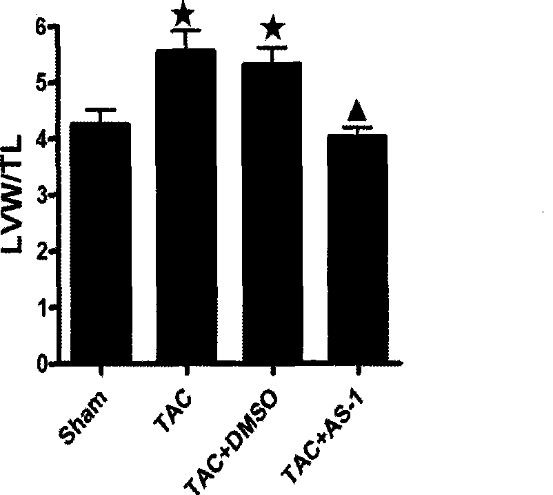 Application of N-[2-methyl-1-(pyrrolidine-1-carbonyl)-propyl]-3-phenyl propionamide in pharmacy