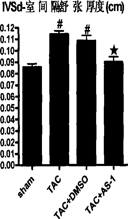 Application of N-[2-methyl-1-(pyrrolidine-1-carbonyl)-propyl]-3-phenyl propionamide in pharmacy