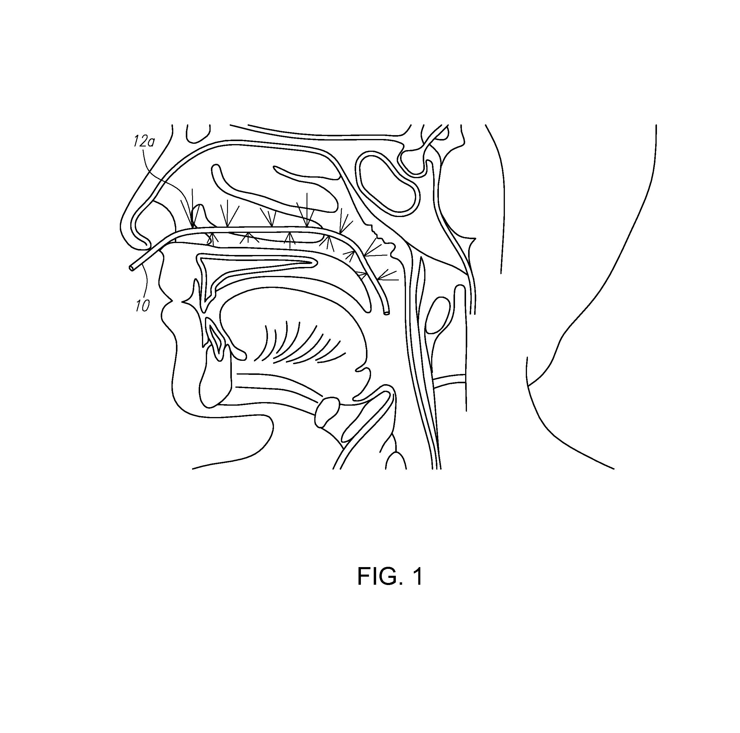 Methods and devices for non-invasive cerebral and systemic cooling alternating liquid mist/gas for induction and gas for maintenance