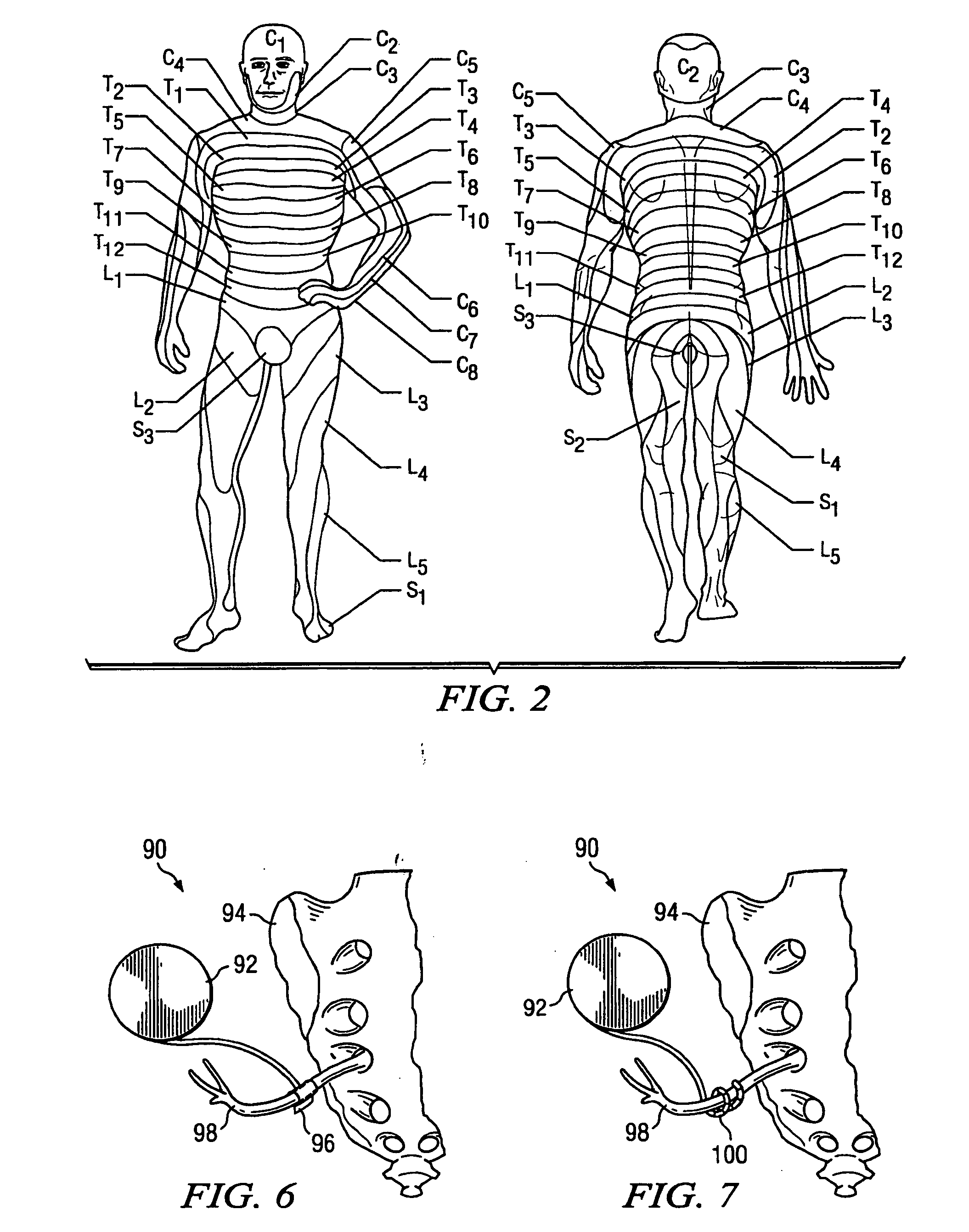 System and method for treatment of sexual dysfunction