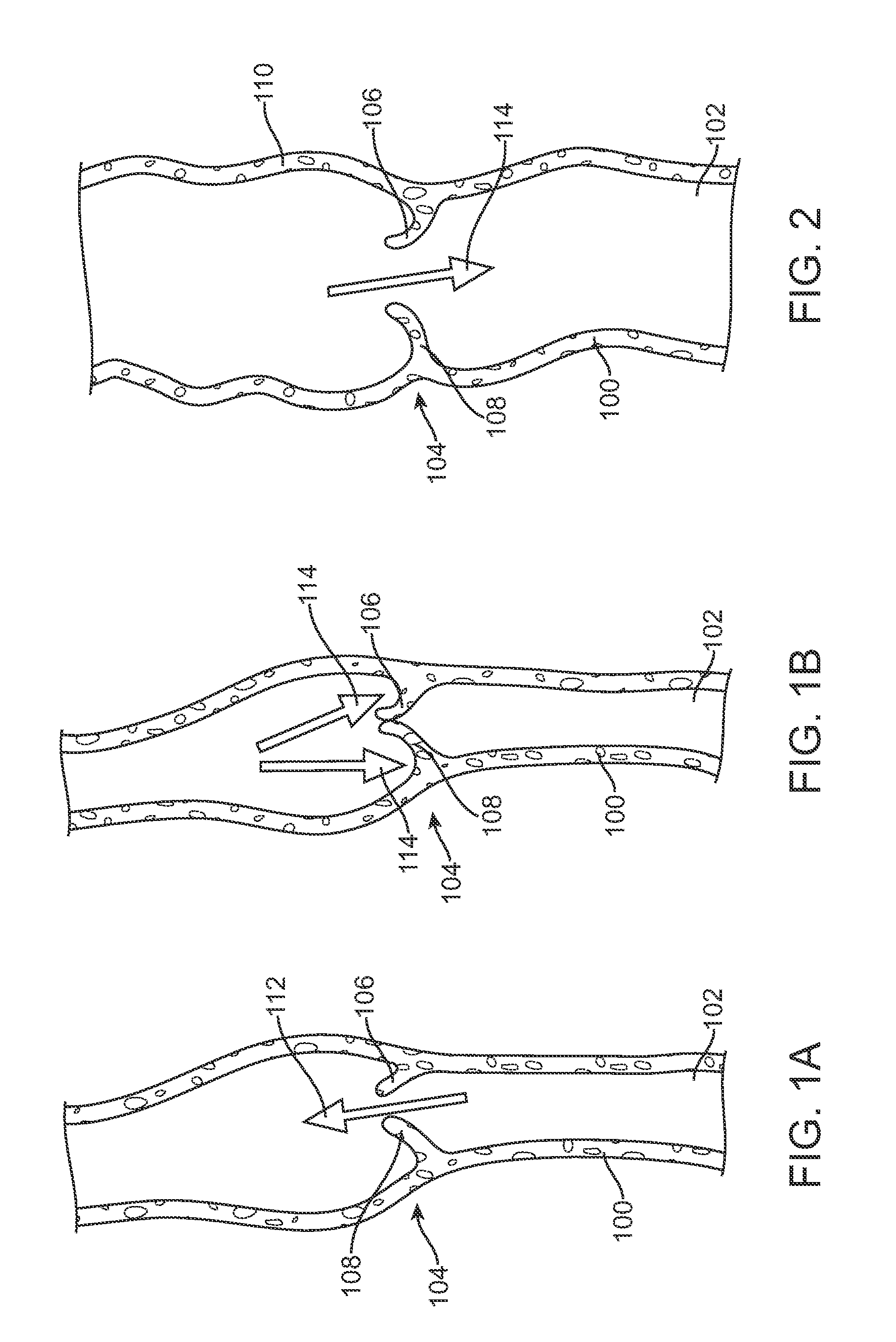 Apparatus and methods for creating a venous valve from autologous tissue
