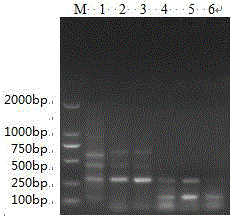 Dual PCR method for detecting theileria hirci and anaplasma