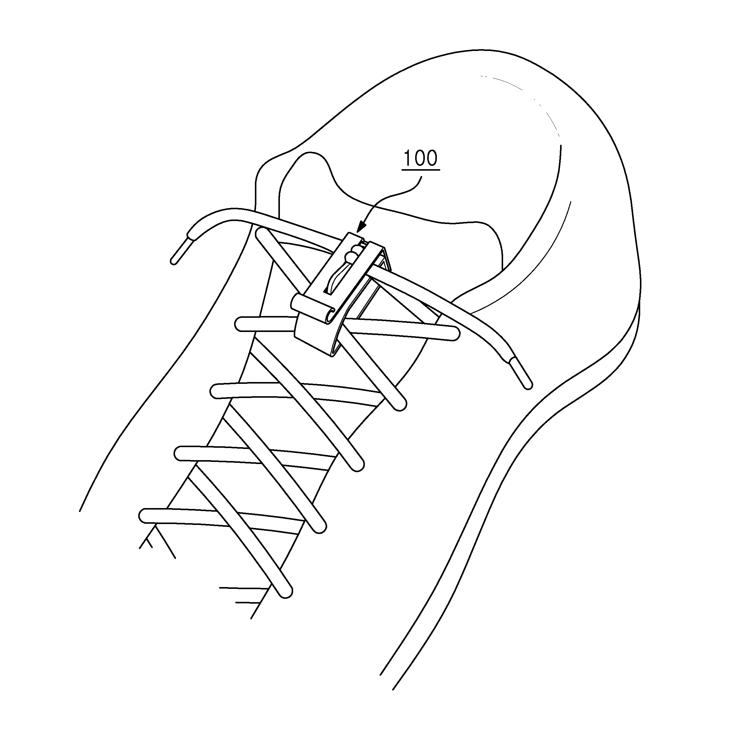 Shoelace retaining device