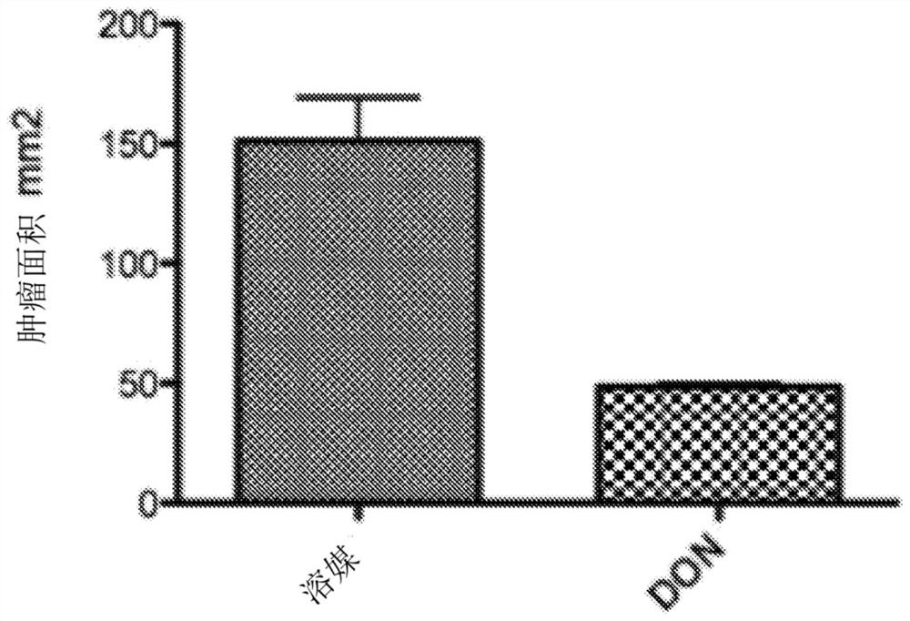 Methods for cancer and immunotherapy using glutamine analogs